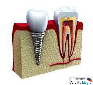 dentist Drumul Taberei